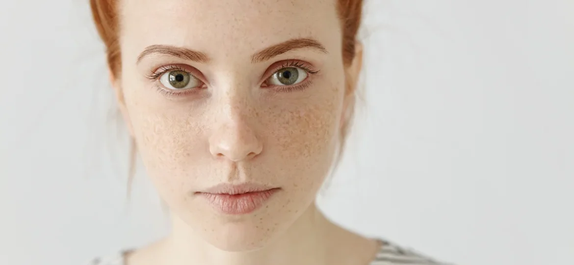 jak-powstają-przebarwienia-przebarwienia-melanina-melanogeneza-zmiany