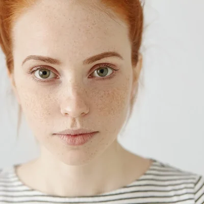 jak-powstają-przebarwienia-przebarwienia-melanina-melanogeneza-zmiany