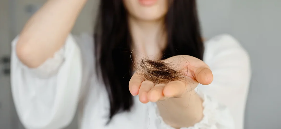 łysienie androgenowe u kobiet mężczyzn przyczyny