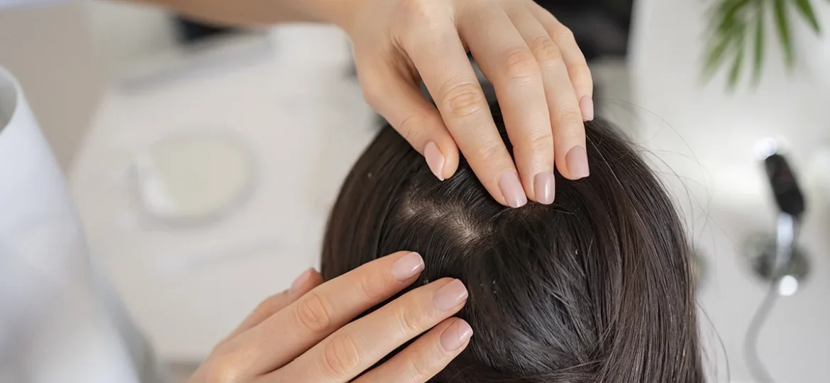 mikrobiota-łupież-skóra-głowy-trycholog-warszawa-konsultacja-trychologiczna