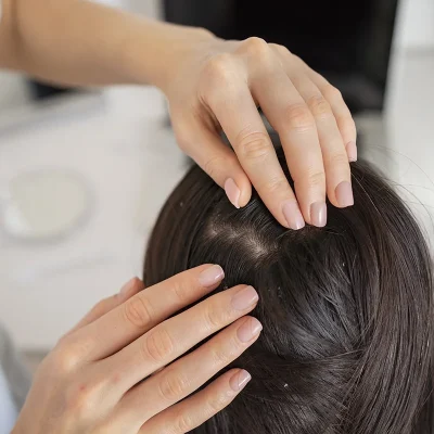 mikrobiota-łupież-skóra-głowy-trycholog-warszawa-konsultacja-trychologiczna