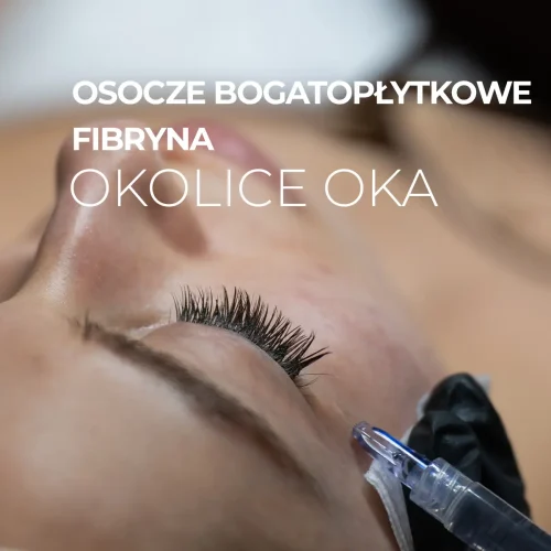 Osocze bogatopłytkowe (PRP) lub Fibryna (iPRF) – okolica oka