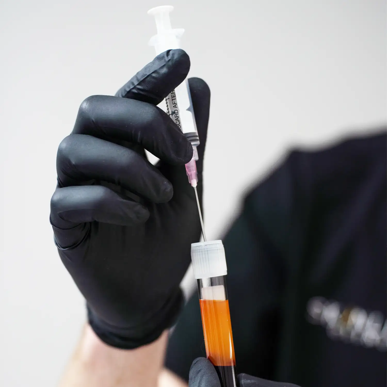 fibryna-bogatoplytkowa-na-skore-glowy-skinline-clinic-warszawa-mokotow