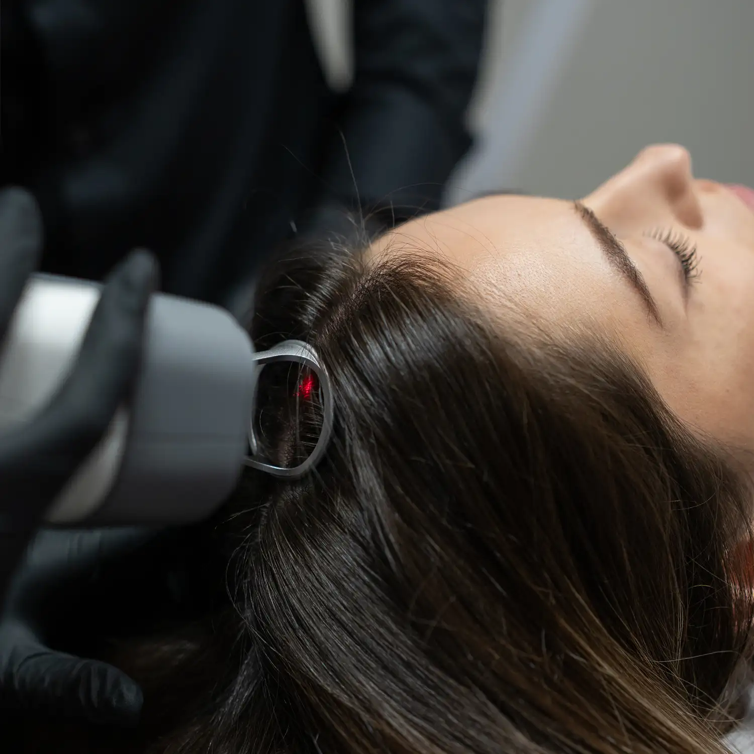 laser-tulowy-na-skore-glowy-warszawa-skinline-clinic