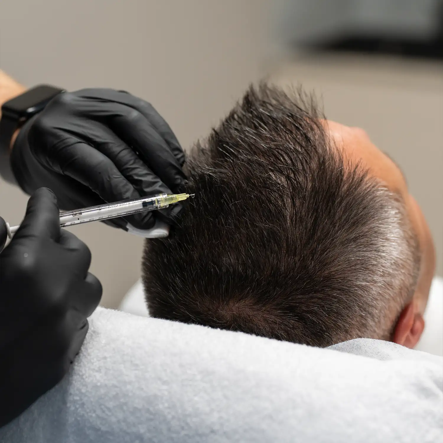 zabieg-autologiczny-plasmoo-warszawa-skinline-clinic-mokotow